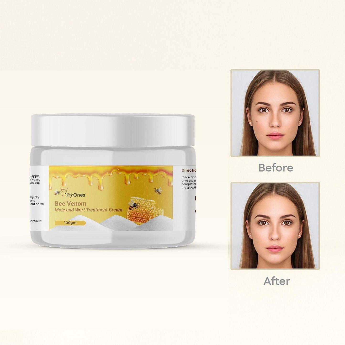 Bee Venom Mole and Wart Treatment Cream 200 gm Buy one Get One Free